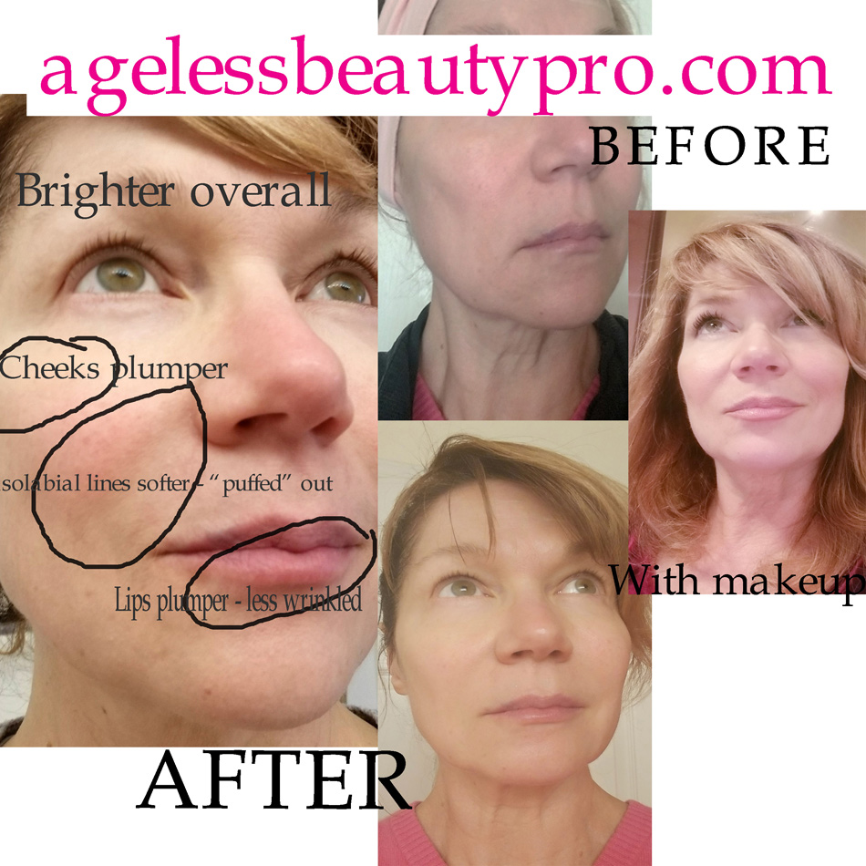 TIME MASTER PRO BEFORE AFTER